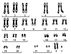 inimese karüogrammi joonis